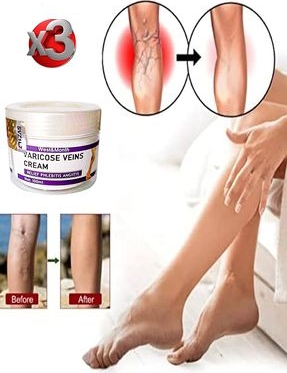 Varicose And Spider Veins Soothing Leg Cream Bacak Bakım Kremi 100 ml x 3 Adet