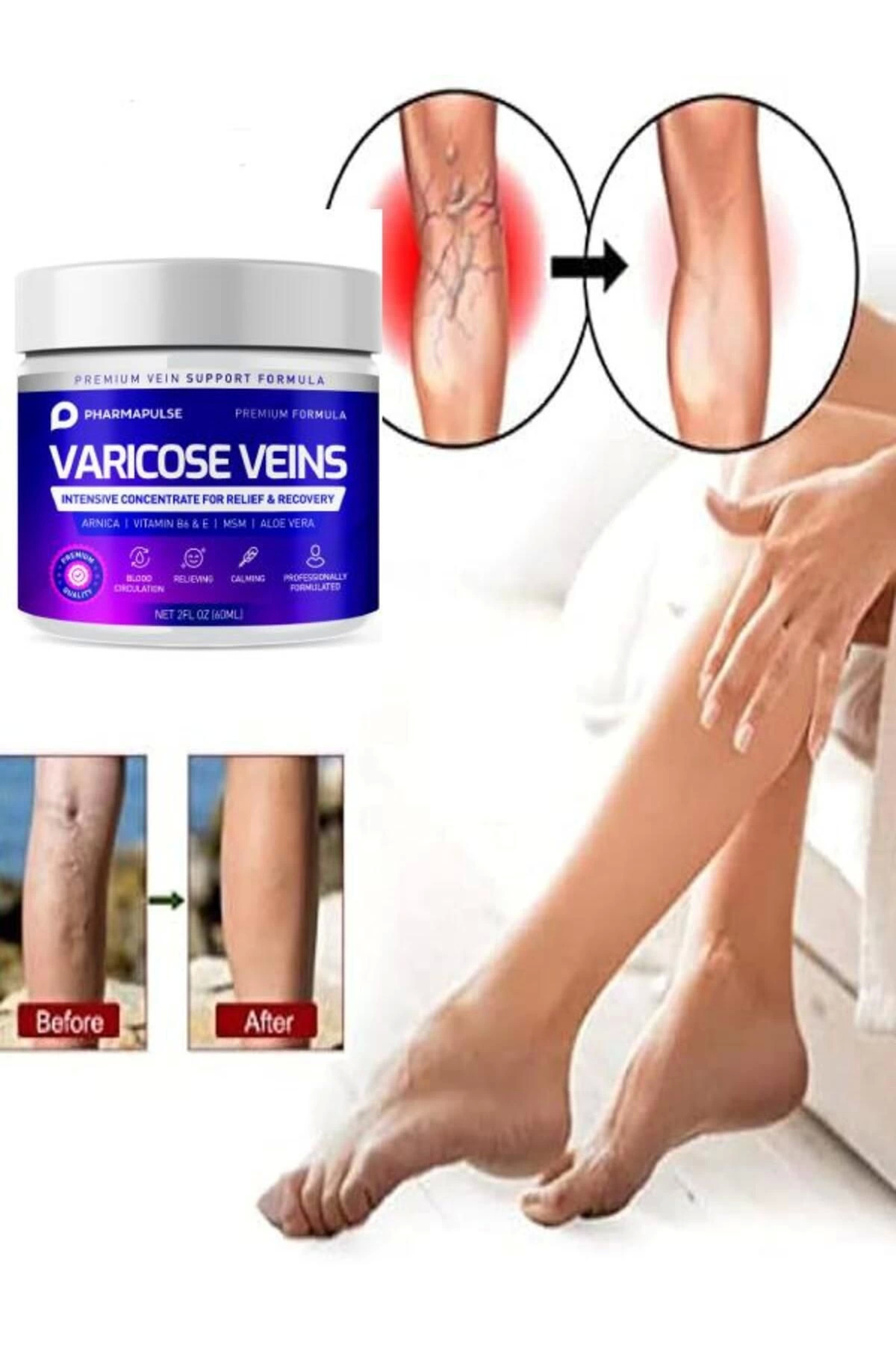 Maximum Strength Varicose Vein Var.is Bacak Bakım Masaj Kremi 100 ml x 2 adet