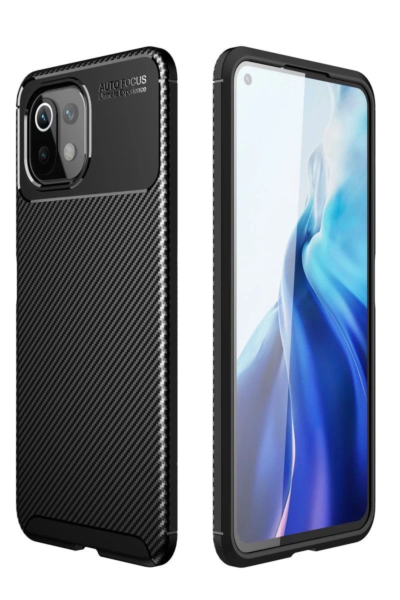 Xiaomi Mİ 11 Lite Uyumlu Kılıf Auto Focus Karbon Kapak - Siyah