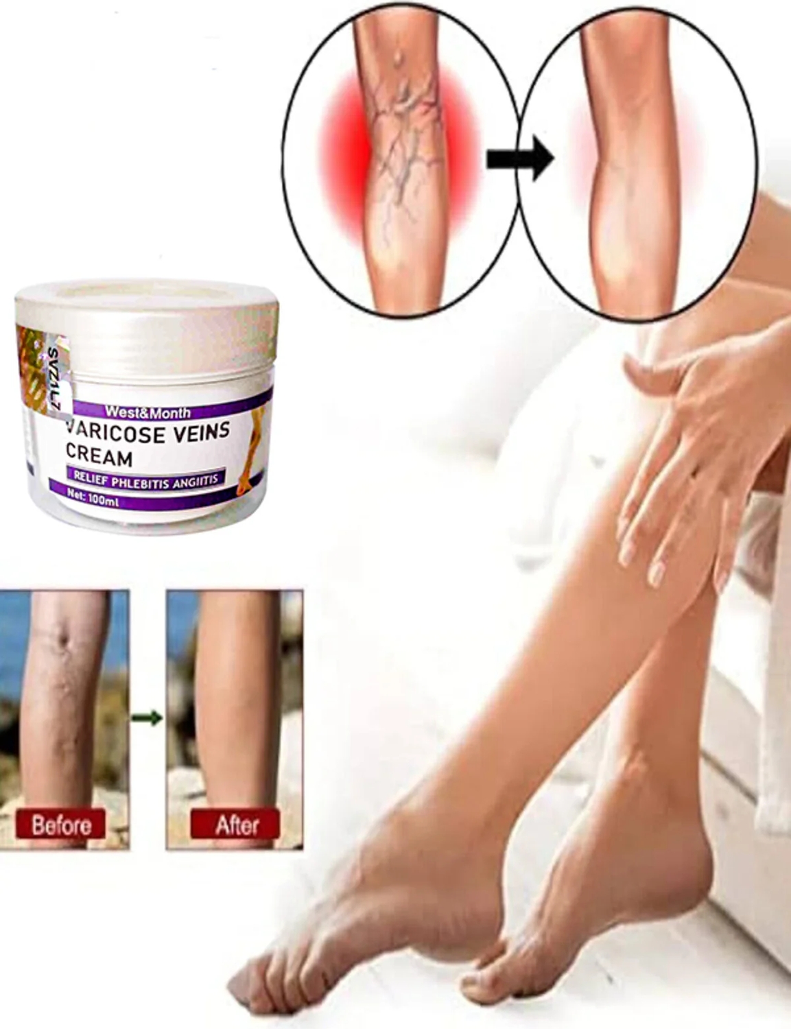 Süper Varix Varcse Vnis Purple Bakım Kremi 100 ml