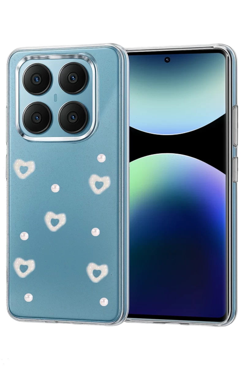 Xiaomi Redmi Note 14 Pro 4G Uyumlu Fiyonk Desenli Kapak - Desen 10