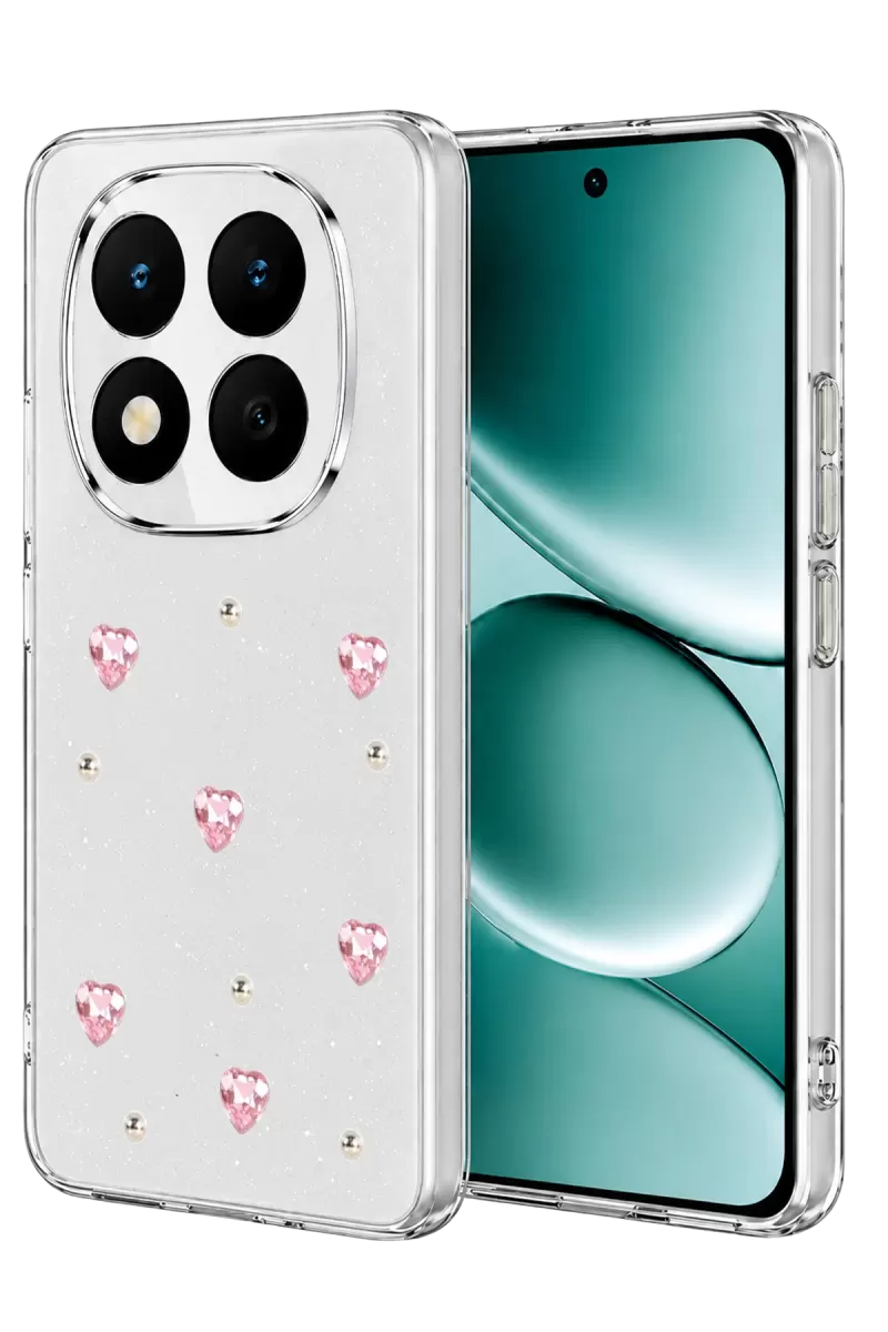 Xiaomi Redmi Note 15 Pro Plus 5G Uyumlu Fiyonk Desenli Kapak - Desen 3