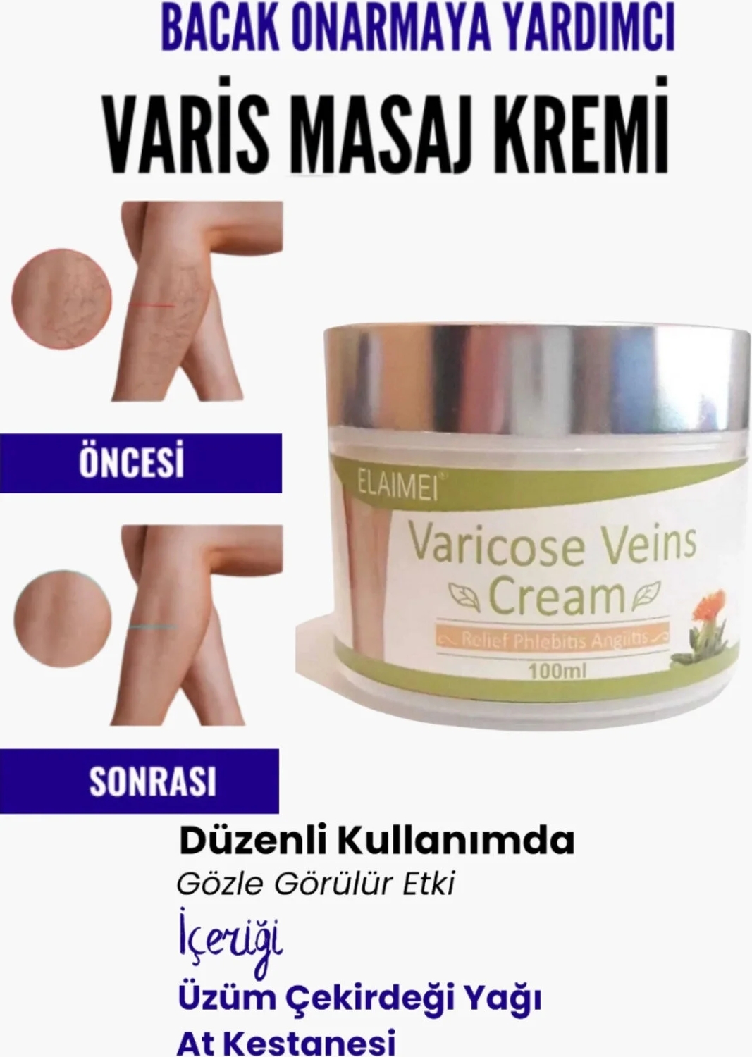 Bacak Varicose Masaj Kremi 100 ml