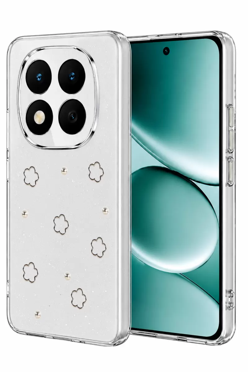 Xiaomi Redmi Note 15 4G Uyumlu Fiyonk Desenli Kapak - Desen 2