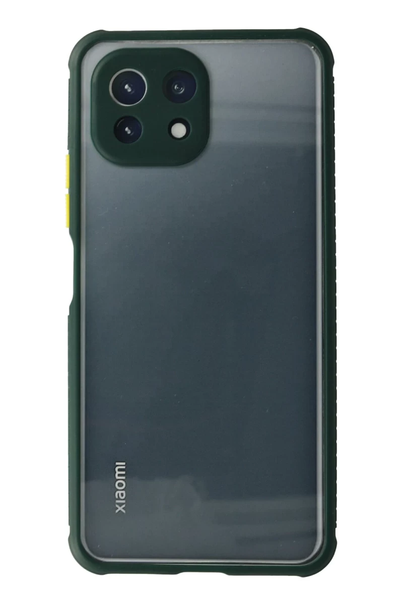 Xiaomi Mİ 11 Lite Uyumlu Kılıf Miami Şeffaf Silikon - Koyu Yeşil